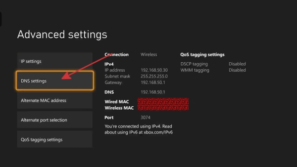 change xbox dns settings